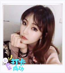 点击看大图 体验后-大麦微针植发全国连锁