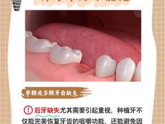 -上海仁爱医院口腔科 · 种植