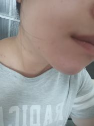 -E.beauty驻颜·痘敏肌调理中心