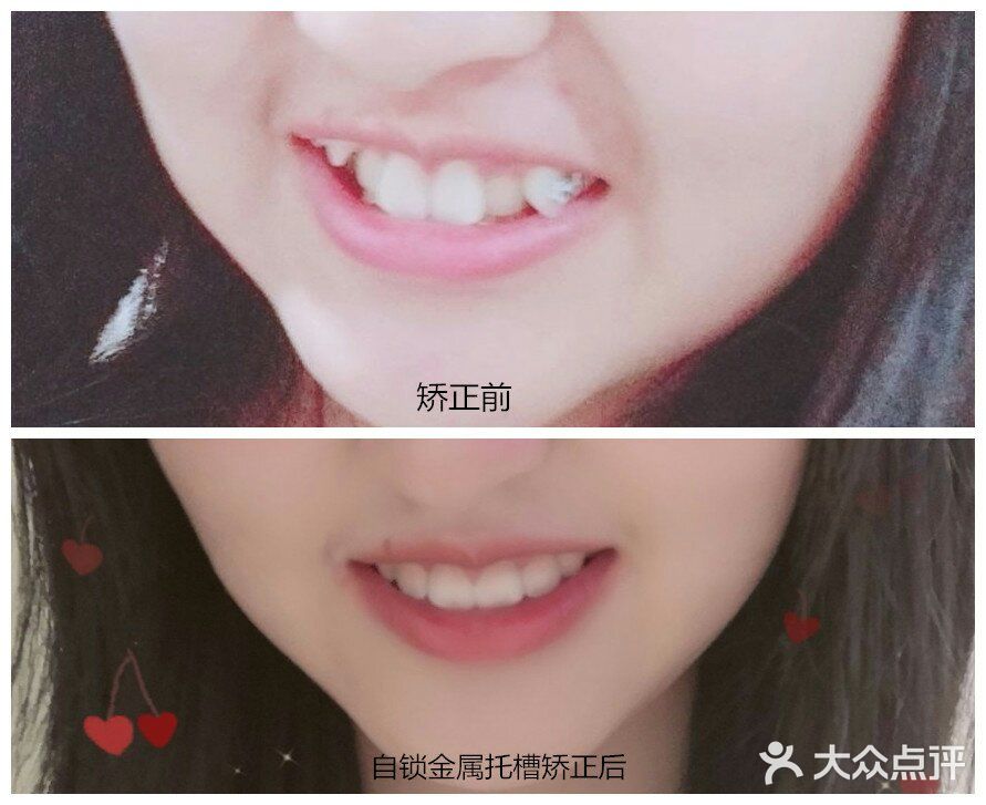 如何有效提升牙齿矫正效率？ .