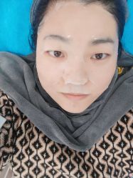 体验后-More摩尔医美の注射线雕光电中心