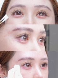 -深圳艺星医疗美容医院