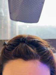 -碧莲盛·不剃发植发