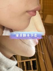 -上海漾颜医疗美容