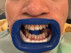 -齐玉齿科JADENTAL