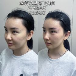 -深圳艺星医疗美容医院