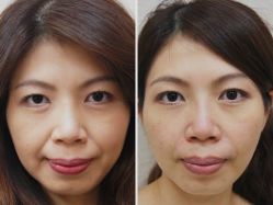 -SKINIST丽铂医疗美容