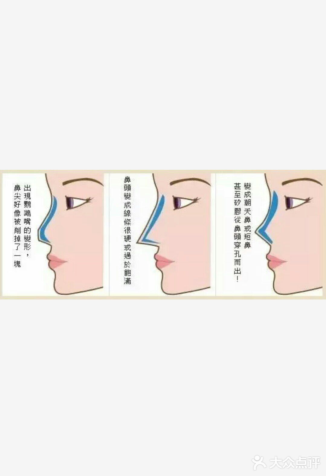 行业内的㊙密，你是否被伪鼻综合迷惑❗❗