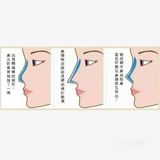 行业内的㊙密，你是否被伪鼻综合迷惑❗❗