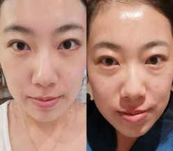 -紫洁俪方（北京）医疗美容