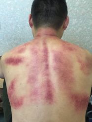点击看大图 -悦艾堂·中医拔罐减肥·美体艾灸连锁