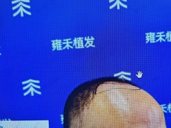 -雍禾植发全国连锁