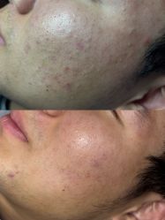 -skin79皮肤管理中心