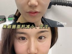 -上海仁爱医院