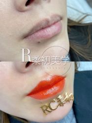 -RC半永久纹眉纹发际线