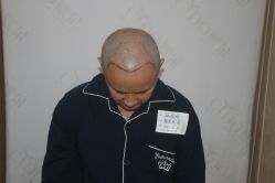 -熙朵美学植发·连锁品牌