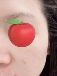 点击看大图 -海涛医疗美容·面部抗衰·注射美鼻