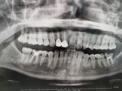 -牙博士口腔品牌连锁(杨浦店)