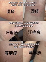 -Fundi张玉珊修身堂·indiba·BTL科技瘦身