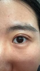 点击看大图 -纯粹医美