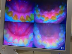 -土豆口腔(凤凰北总店)