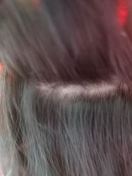 -碧莲盛·不剃发植发