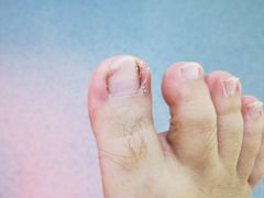 -新甲连锁灰指甲·甲沟炎·鸡眼(黑龙江路店)