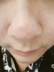 -优活悦妍美肤养生抗衰中心