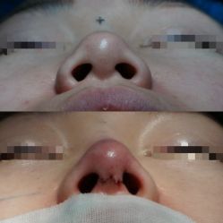 -天津伊美尔医疗整形美容专科医院