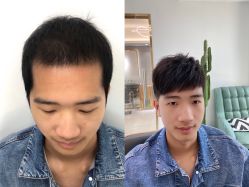 -发饰美男士增发补发假发定制店