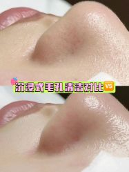 -凡碧诗毛孔清洁收细