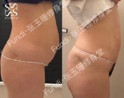 -Fundi张玉珊修身堂·indiba·BTL科技瘦身