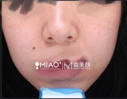 -韩国淼美颜皮肤管理官方直营店