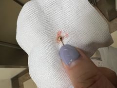 -上海市第一人民医院(松江南部)