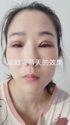 体验后-南京医科大学友谊整形外科医院