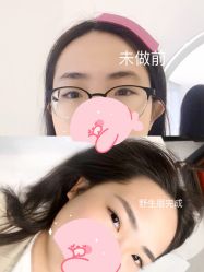 -MIVI半永久纹眉纹绣
