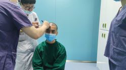 -大麦微针植发全国连锁