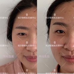 -悦汐颜美肌抗衰中心