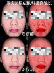 -Yestar重庆艺星医疗美容医院