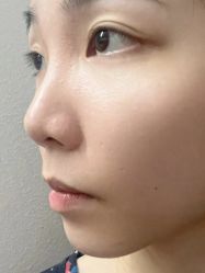 -广州美莱医疗美容医院