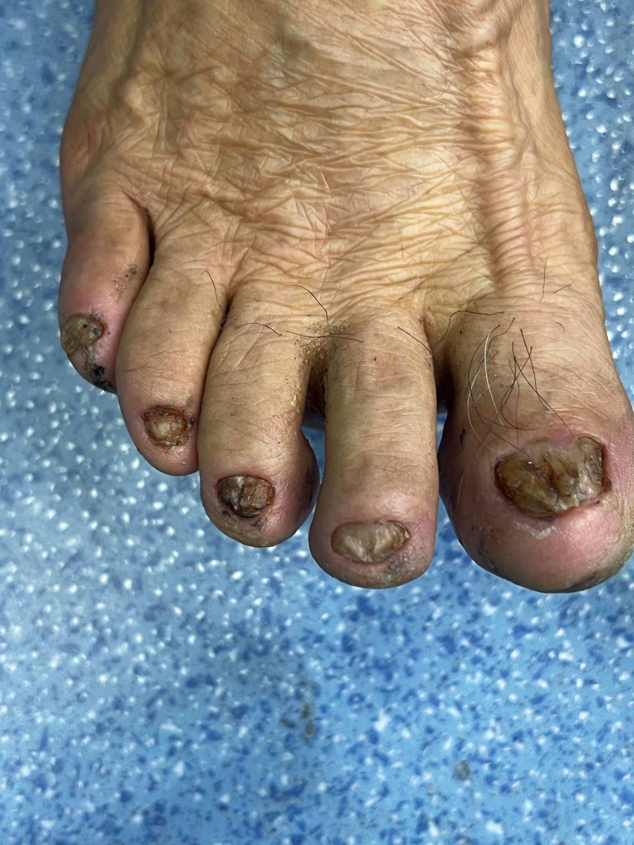 脚脚不行了,生病了,肿么办?找民医堂徽杰