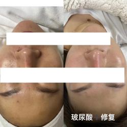 -LUNA皮相美·骨相美高级美感