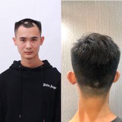 -发饰美男士增发补发假发定制店