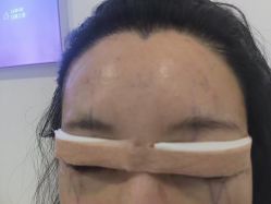-长沙雅美医疗美容医院