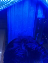 -碧莲盛·不剃发植发