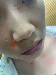 -百年美肤堂祛痦痣祛斑祛疣
