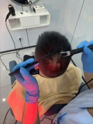 -大麦微针植发丨全国连锁