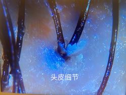 点击看大图 -妍理·植物养发