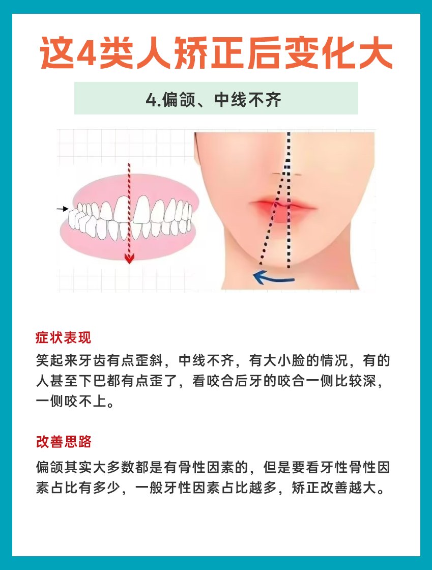 下巴后缩还能恢复吗图片