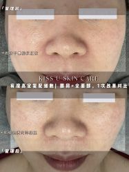 -KISS U 国际美学